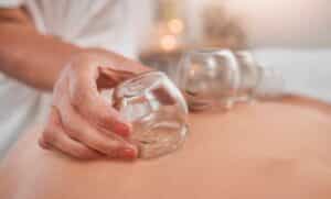 Woman receiving cupping therapy in a spa setting, emphasizing relaxation, holistic healing, and alternative medicine for health and skincare